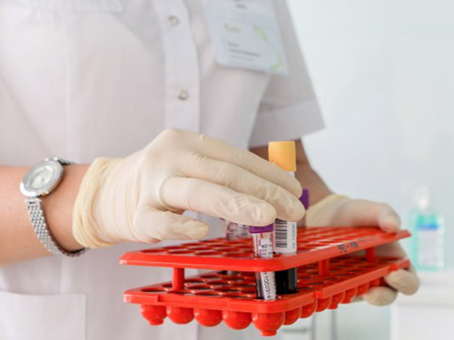 Москва закупает тесты на коронавирус у фирм без телефона и медицинской лицензии